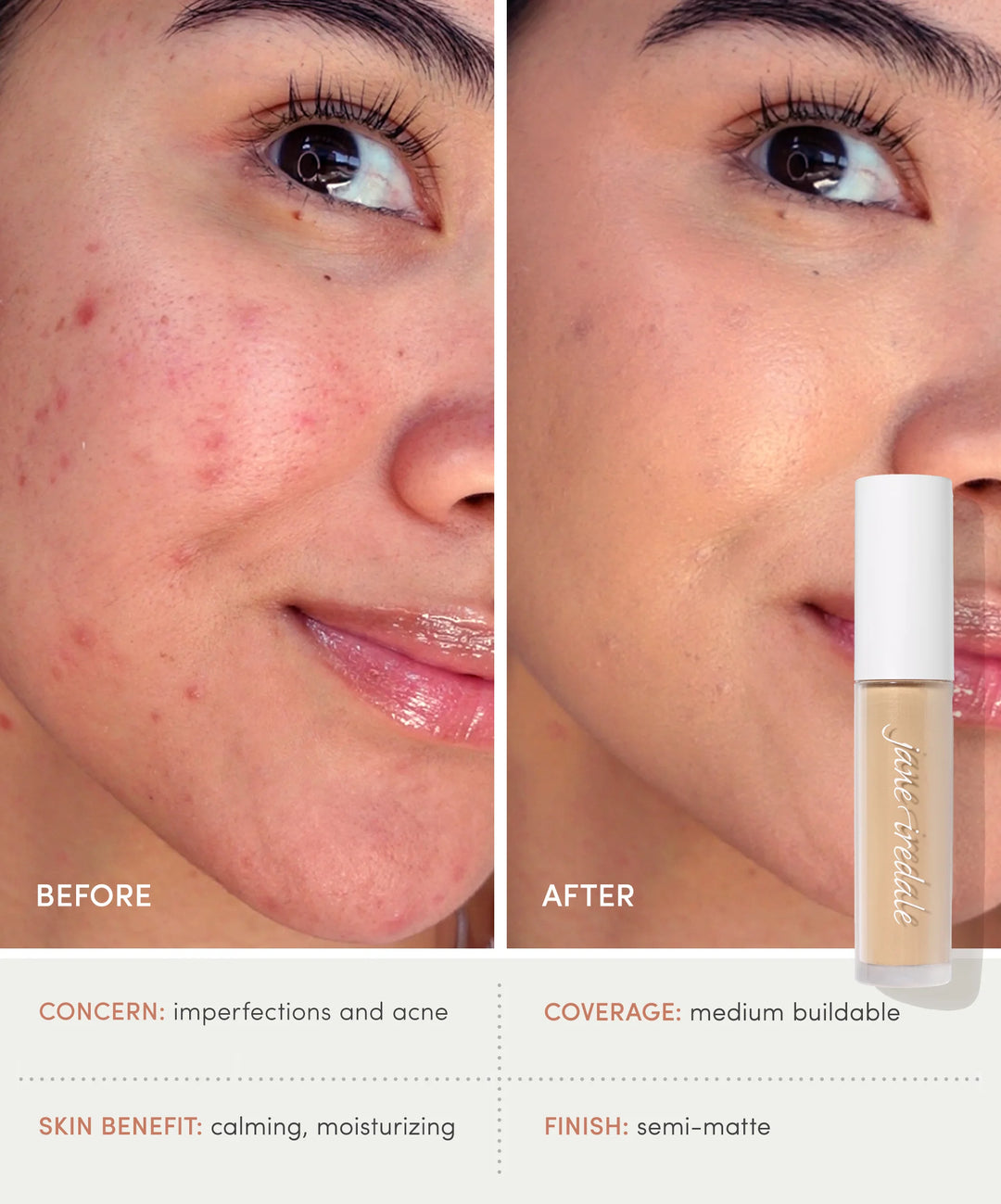 Before and after comparison of skin with acne, featuring PureMatch Liquid Foundation as it covers imperfections and acne